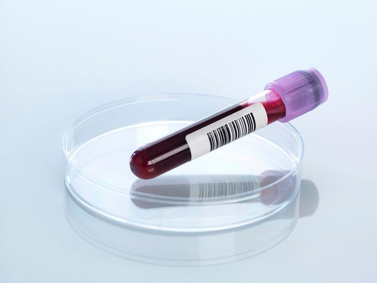 Los investigadores analizaron muestras de sangre de Branyas. (Foto genérica)