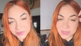 La artista se graba en modo selfie desde la casa de una amiga donde hará su postoperatorio. / Instagram La artista se graba en modo selfie desde la casa de una amiga donde hará su postoperatorio. / Instagram