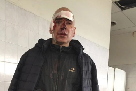 El maratonista herido Foto: NA