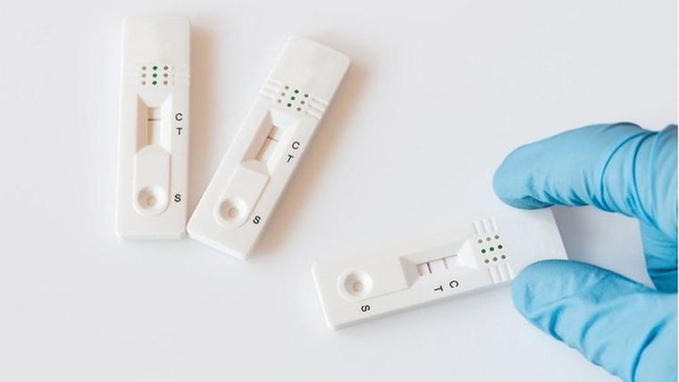 Los especialistas advierten que un resultado negativo en los primero días de síntomas deben ser tomados con cautela Foto: GETTY IMAGES