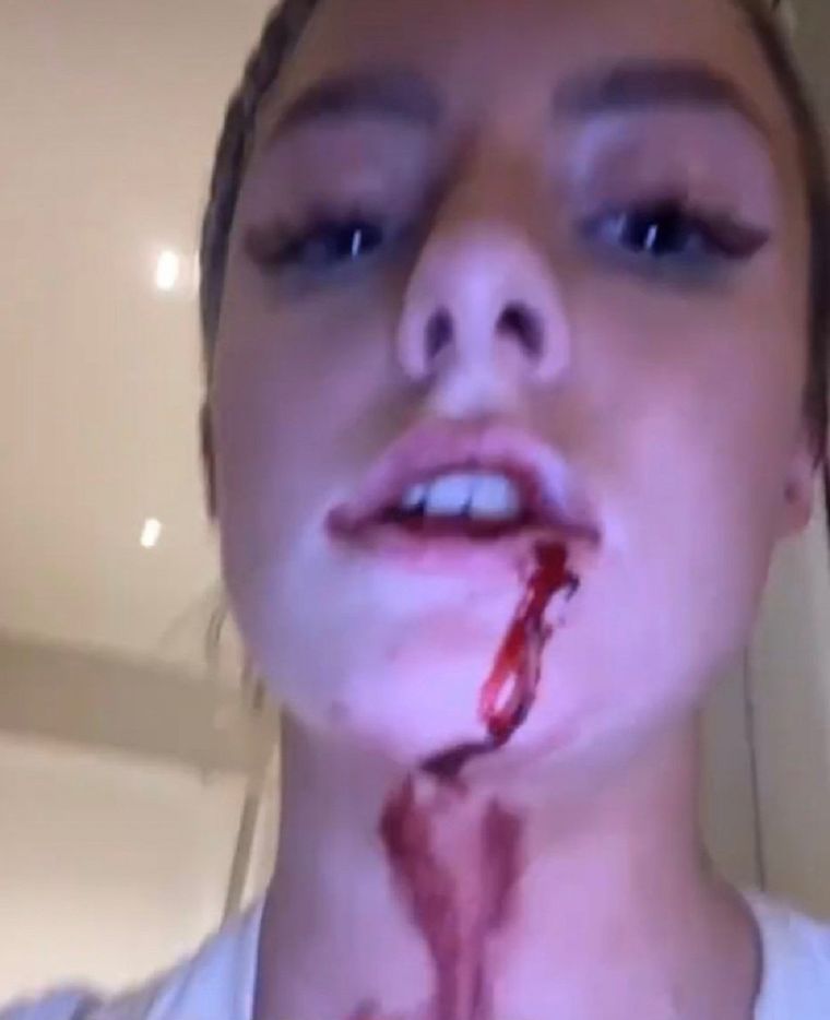 Una de las imágenes que compartió Harriet Robson. Foto: Captura