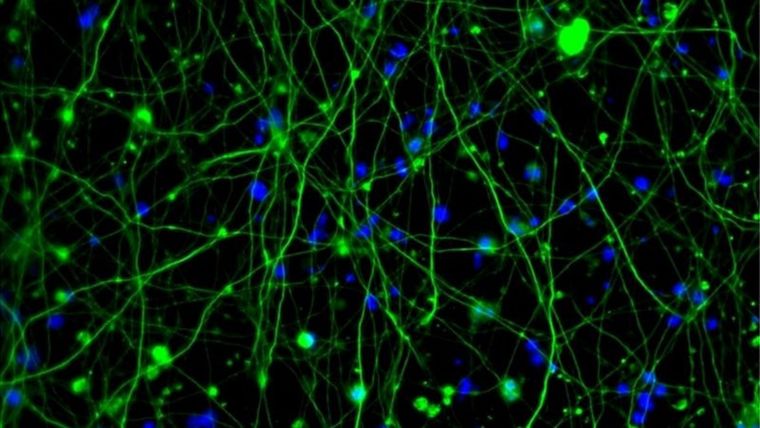 El minicerebro de Phil.