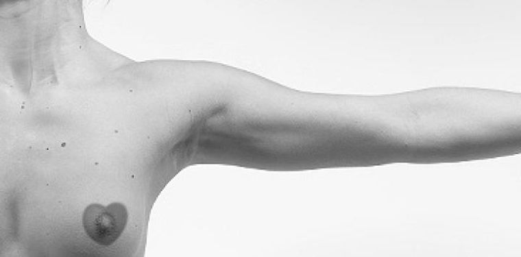 Foto: www.webconsultas.com