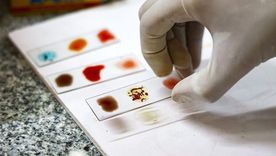 Solo se conocen 50 personas en el mundo con el tipo de sangre Rh nulo.