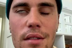 Bieber muestra los efectos del síndrome de Ramsay Hunt Foto: INSTAGRAM/JUSTIN BIEBER