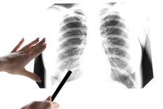 El virus estaría circulando desde hace más de 60 años, pero fue descubierto en 2001 Foto: Shutterstock