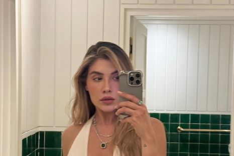 La hija de Luis Miguel tiene melasma. Fuente: Instagram. La hija de Luis Miguel tiene melasma. Fuente: Instagram.