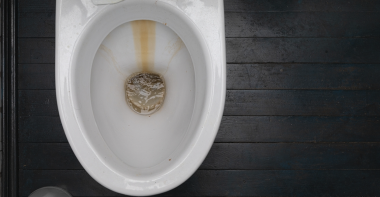 El sarro puede ser el mayor enemigo de la limpieza del baño. Foto: Archivo