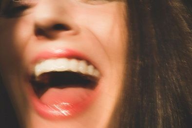 MDZol | Muchas veces nos enfocamos solo en la salud de los dientes, pero el resto de tu boca tiene información muy valiosa que darte Foto: GETTY IMAGES