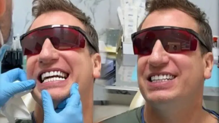 Maxi López luce su nueva sonrisa tras someterse a un tratamiento de carillas dentales de alta gama. Maxi López luce su nueva sonrisa tras someterse a un tratamiento de carillas dentales de alta gama.