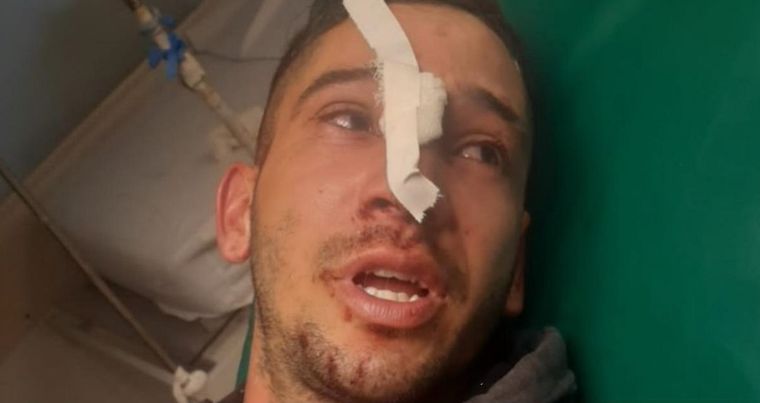 Las imágenes de la víctima