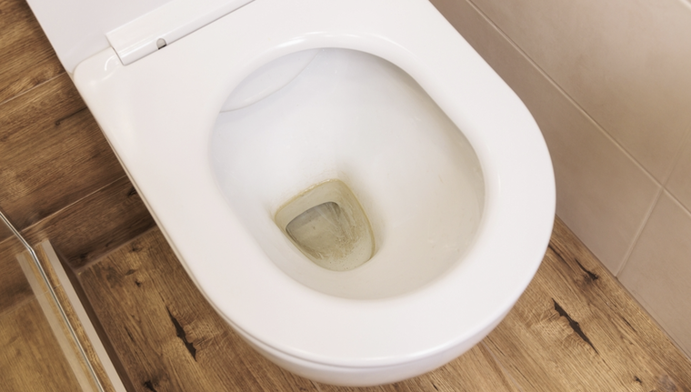 Adiós a las desagradables manchas en el fondo del inodoro. Foto: Shutterstock