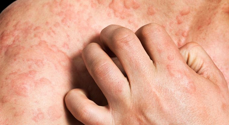 Foto: Salud para todos