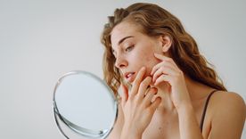 Un problema emocional detrás del acné. Un problema emocional detrás del acné.