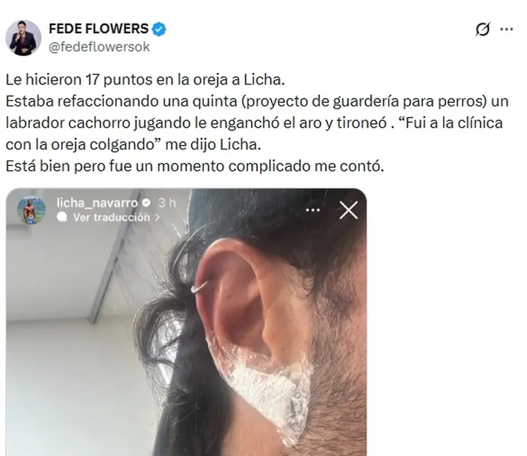 El periodista Fede Flowers fue el encargado de confirmar los detalles del drama de Navarro. El periodista Fede Flowers fue el encargado de confirmar los detalles del drama de Navarro.