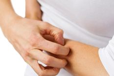 La picazón es uno de los síntomas más molestos de la dermatitis.