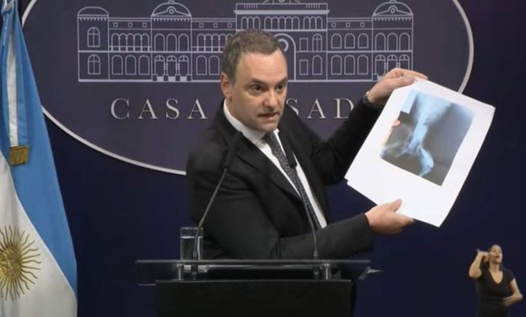 El vocero presidencial, Manuel Adorni, anunció la detención de 14 delincuentes prófugos que cobraban pensiones por invalidez. Foto: Captura de pantalla