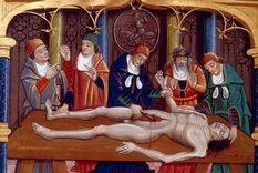 Ilustración medieval de una autopsia realizada en la edad media. Del manuscrito francés Las propiedades de las cosas de Bartholomaeus Anglicus, finales del siglo XV. Foto: GETTY IMAGES Foto: GETTY IMAGES