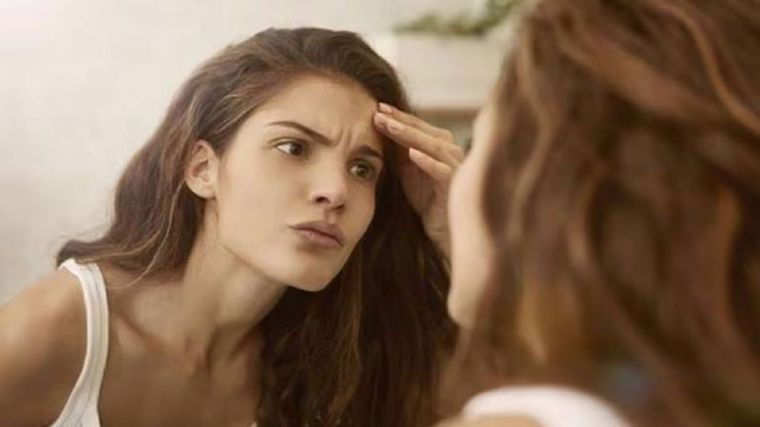 Esta fórmula casera te ayudará a eliminar las manchas de tu rostro Foto: Shutterstock