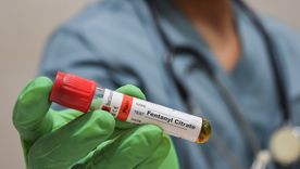 El fentanilo es un opioide agonista sintético que se utiliza como analgésico en distintas intervenciones, puesto que su potencia es inclusive superior a la morfina. 