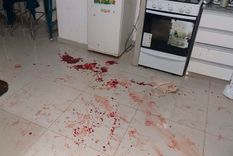 La mujer fue golpeada con un elemento contundente por su pareja que se suicidó/Imagen Ilustrativa Foto: Archivo