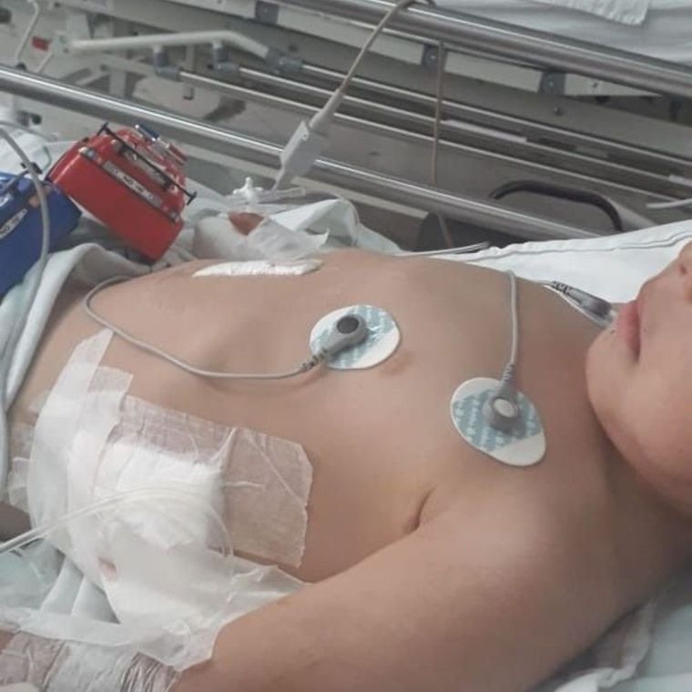 El nene tuvo que ser operado y está en terapia