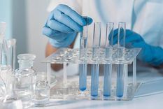 Las muestras fueron enviadas al Malbrán Foto: MEDAC