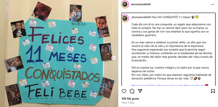 El 30 de agosto, Felipe cumplió 11 meses de vida y su familia lo celebró como una conquista. El 30 de agosto, Felipe cumplió 11 meses de vida y su familia lo celebró como una conquista.