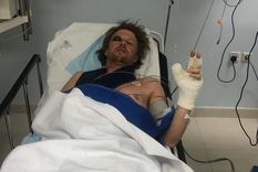 asi quedo van beveren luego de la terrible caida que lo hizo abandonar