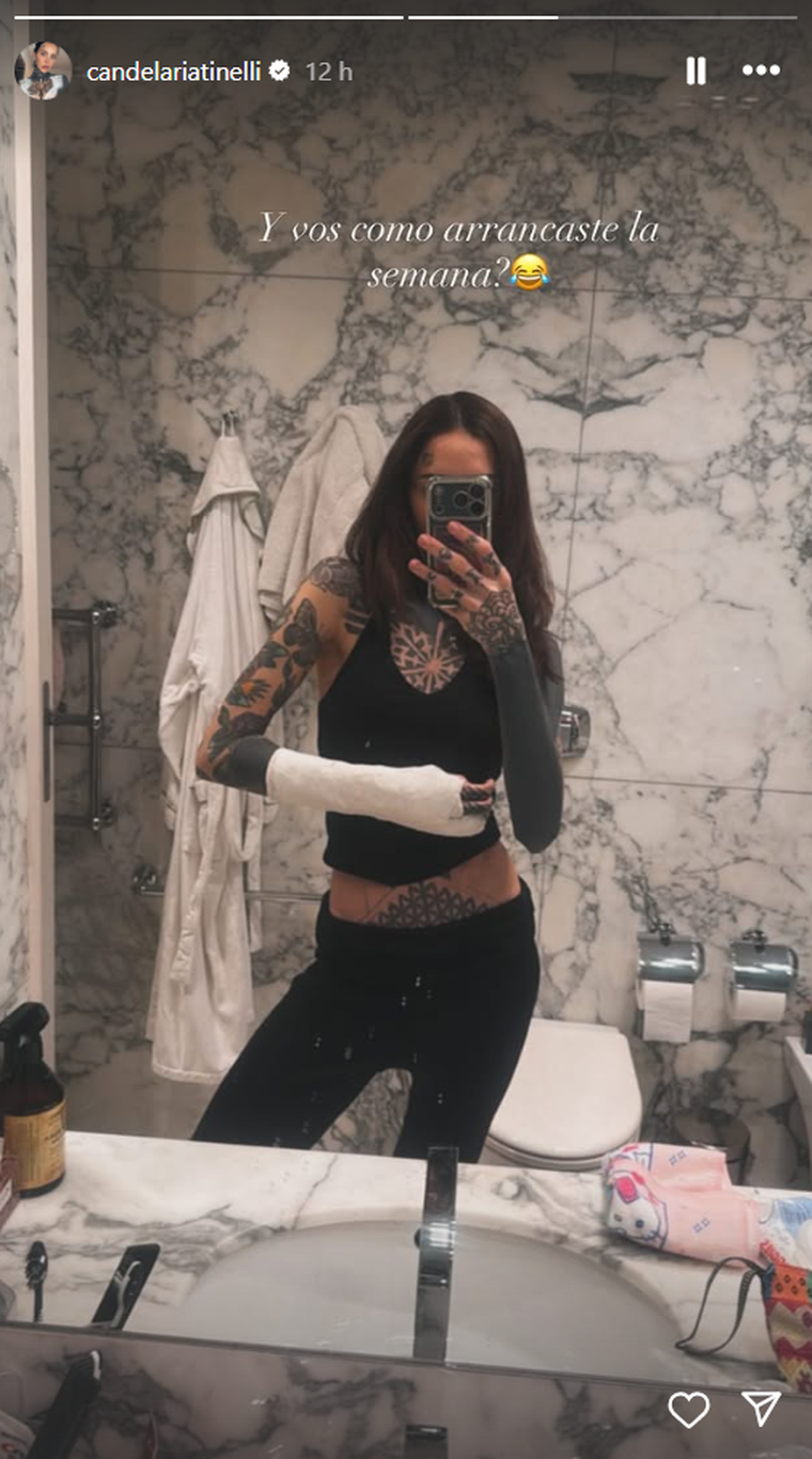 Cande Tinelli sufrió un fuerte accidente y tuvo que ser operada. Foto: Instagram/ @candelariatinelli. Cande Tinelli sufrió un fuerte accidente y tuvo que ser operada. Foto: Instagram/ @candelariatinelli. 