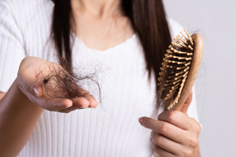Caída del pelo Un sueño para analizar. Foto: Fuente: Shutterstock