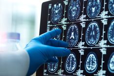 Los traumatismos en la cabeza pueden generar alteraciones cerebrales.