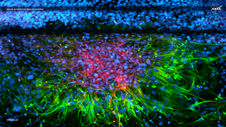 La imagen de marzo muestra cómo se mueve la radiación en el espacio, usando colores para representar energía invisible para el ojo humano. La imagen de marzo muestra cómo se mueve la radiación en el espacio, usando colores para representar energía invisible para el ojo humano.
