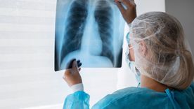 Según datos del Boletín Epidemiológico Nacional, la tasa de notificación de tuberculosis en el país muestra un incremento del 29% respecto al promedio de los últimos años. Según datos del Boletín Epidemiológico Nacional, la tasa de notificación de tuberculosis en el país muestra un incremento del 29% respecto al promedio de los últimos años.