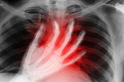 MDZol | La PRN es una técnica de trasplante que ha permitido aumentar la cantidad de órganos que se pueden utilizar exitosamente. Foto: GETTY IMAGES