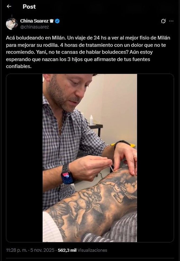 El primer dardo de la China a Yanina. El primer dardo de la China a Yanina.