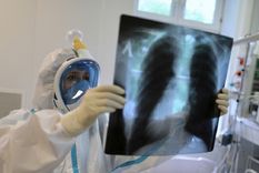 el diagnostico temprano de la tuberculosis evita secuelas de por vida