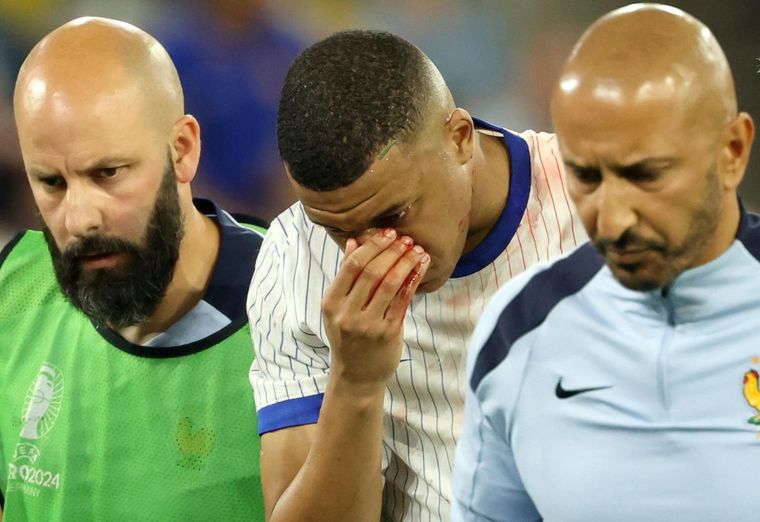 Mbappé fue retirado del campo. Foto: EFE