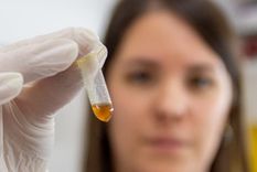 Las numerosas investigaciones sobre VPH señalan al genotipo de alto riesgo como la causa para el desarrollo del cáncer de cuello de útero Foto: Unciencia