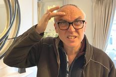 El reportero de la BBC Ed Butler, de 54 años, decidió someterse a uno de los procedimientos más populares: el bótox.