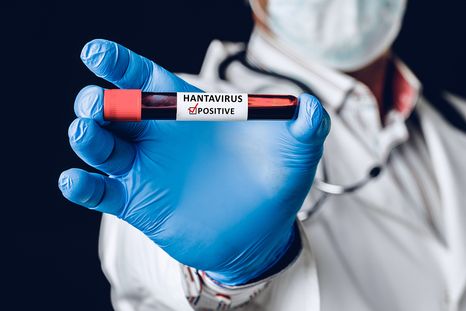 El hantavirus es una enfermedad viral. El hantavirus es una enfermedad viral.