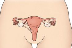 la silenciosa enfermedad que afecta a una de cada diez mujeres