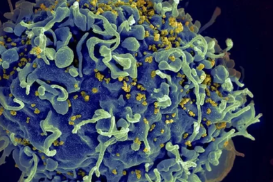 MDZol | Esta electromicrografía muestra al virus VIH infectando una célula humana. La variante VB generó una mayor carga viral en pacientes que aún no reciben tratamiento Foto: GETTY IMAGES