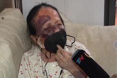 Así quedó la jubilada que fue brutalmente asaltada Foto: archivo/imagen ilustrativa Así quedó la jubilada que fue brutalmente asaltada Foto: archivo/imagen ilustrativa
