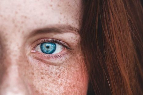 Un efecto del ácido retinoico, importante desde el punto de vista cosmético, es que estimula la síntesis de colágeno e inhibe su degradación. Foto: Unsplahs