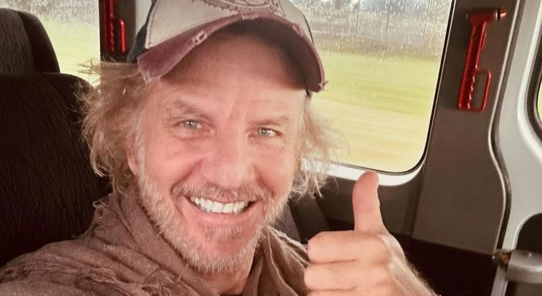 Facundo Arana tiene carcinoma, un cáncer de piel El actor emocionó con un posteo buscando concientizar sobre la prevención Foto: @facundoaranatagle