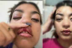 Personal médico constató hematomas en el rostro, costillas, brazos y piernas. Foto: X. Personal médico constató hematomas en el rostro, costillas, brazos y piernas. Foto: X.
