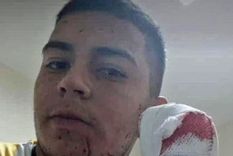 Martin Abraham fue asaltado: le tiraron un machetazo a la cabeza pero interpuso su mano para salvarse