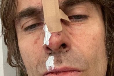 MDZol | Liam Gallagher