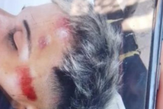 Joven inconsciente tras la brutal pelea Foto: NA Joven inconsciente tras la brutal pelea Foto: NA